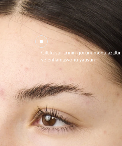 Kusur Azaltıcı