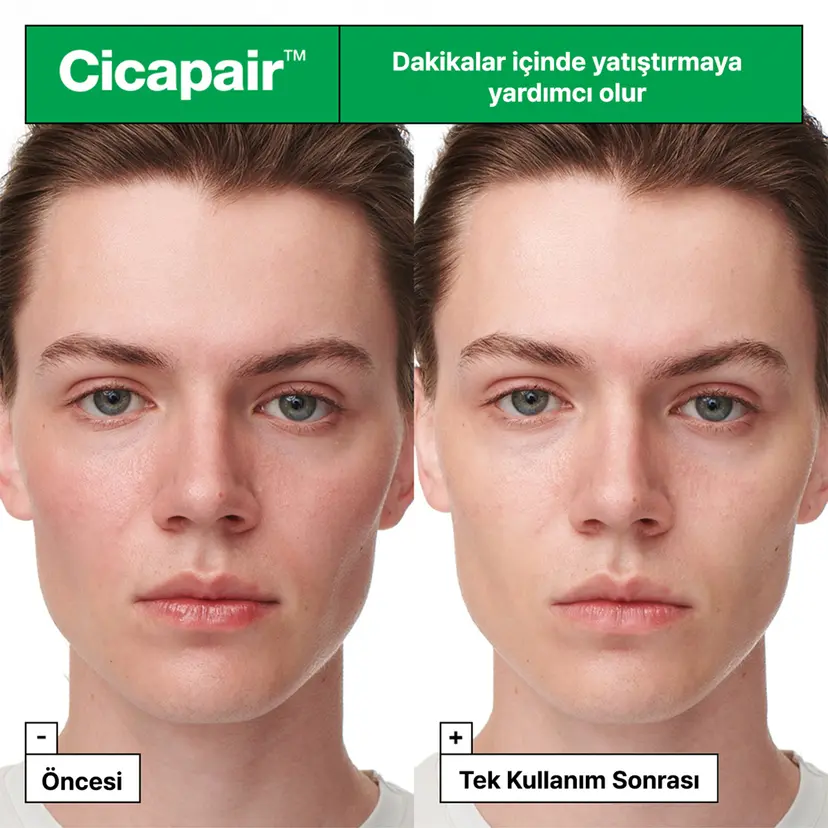 Dr. Jart+ Cicapair Cilt Yatıştırıcı Krem Etkisi